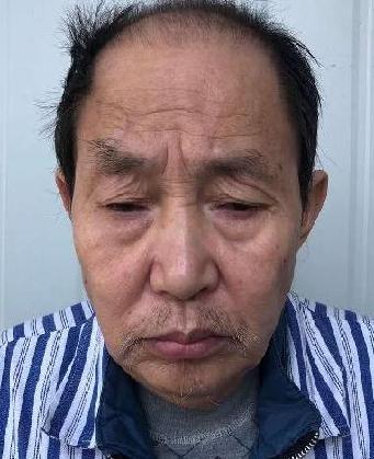 走失者照片 全国救助站