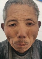 走失者照片 全国救助站
