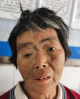走失者照片 全国救助站