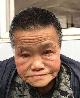 走失者照片 全国救助站