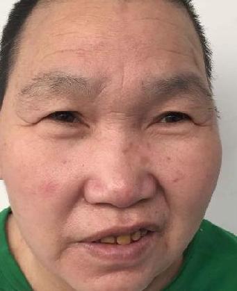 走失者照片 全国救助站