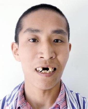 走失者照片 全国救助站