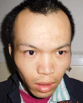 走失者照片 全国救助站