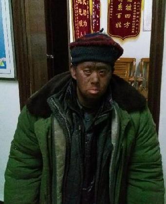 走失者照片 全国救助站