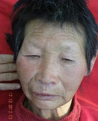 走失者照片 全国救助站