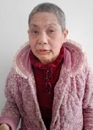 走失者照片 全国救助站