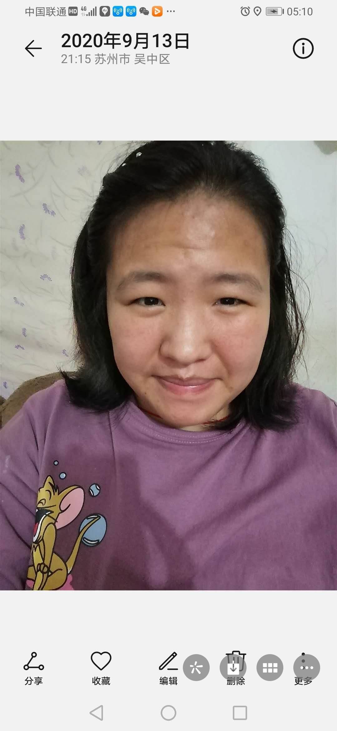 走失者照片 请大家爱心传替，帮忙寻找，家人都很...