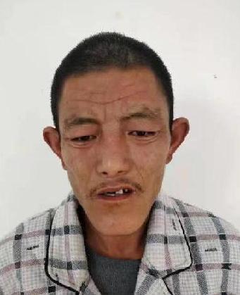 走失者照片 全国救助站