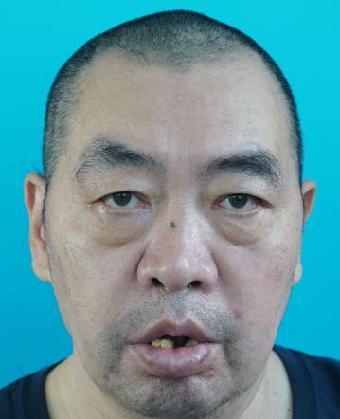 走失者照片 全国救助站