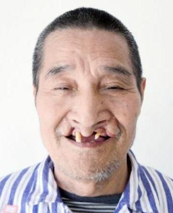 走失者照片 全国救助站
