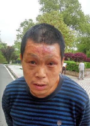 走失者照片 全国救助站