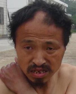 走失者照片 全国救助站