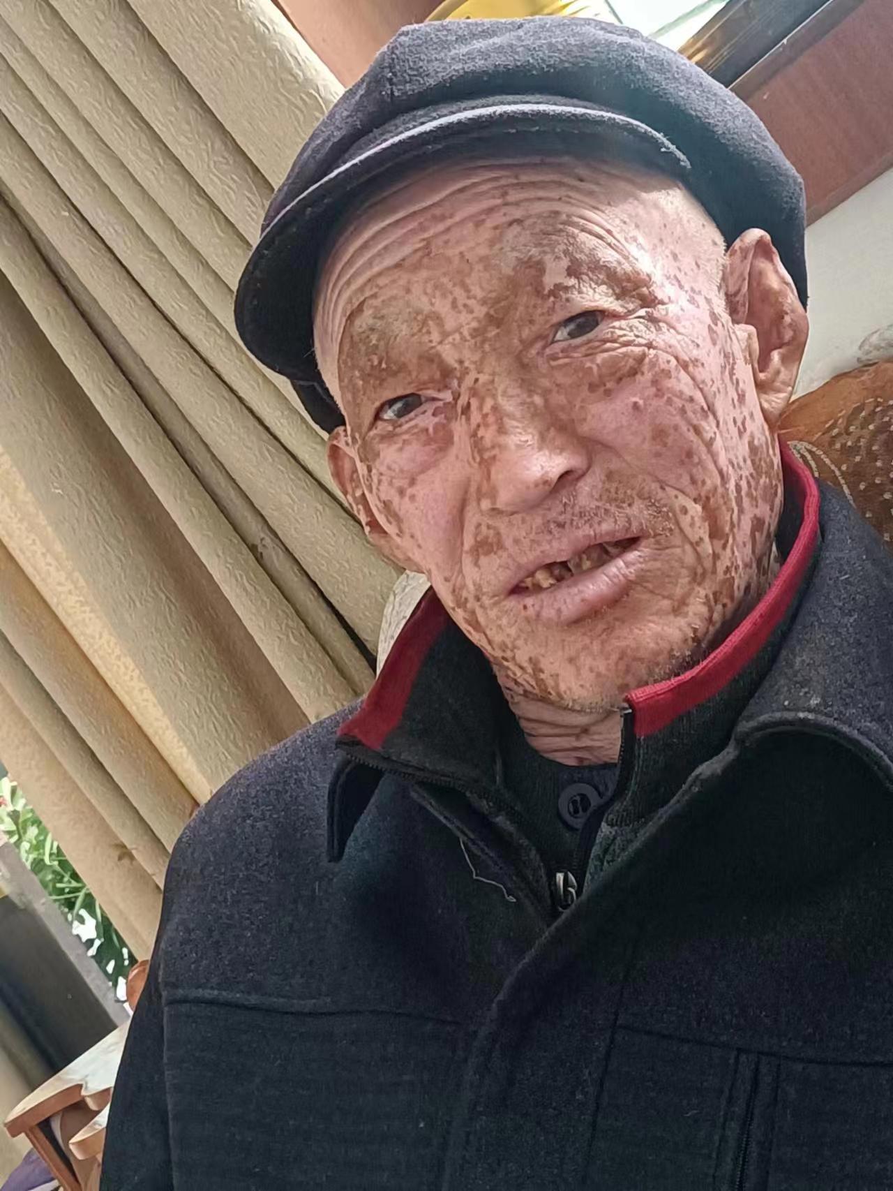 走失者照片 请求大家帮忙扩散，好人一生平安? ...