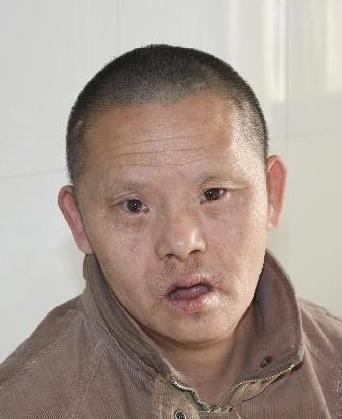 走失者照片 全国救助站