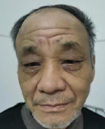 走失者照片 全国救助站