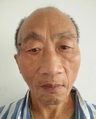 走失者照片 全国救助站