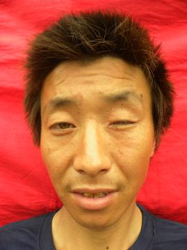 走失者照片 全国救助站