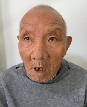 走失者照片 全国救助站