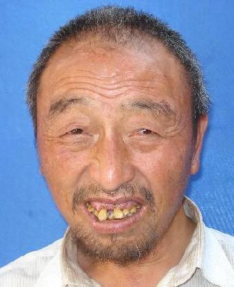 走失者照片 全国救助站