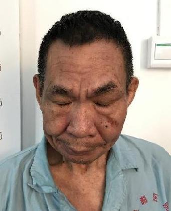 走失者照片 全国救助站