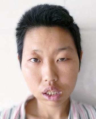走失者照片 全国救助站