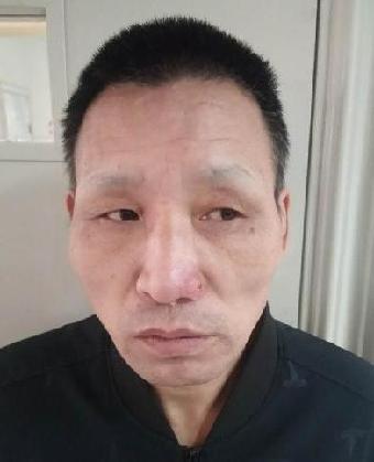 走失者照片 全国救助站