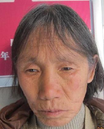 走失者照片 全国救助站