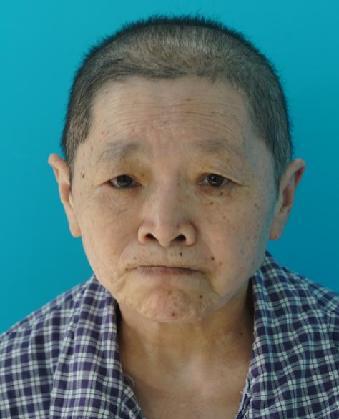 走失者照片 全国救助站