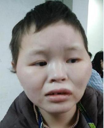 走失者照片 全国救助站
