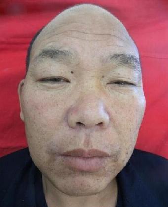 走失者照片 全国救助站