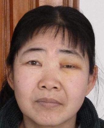 走失者照片 全国救助站