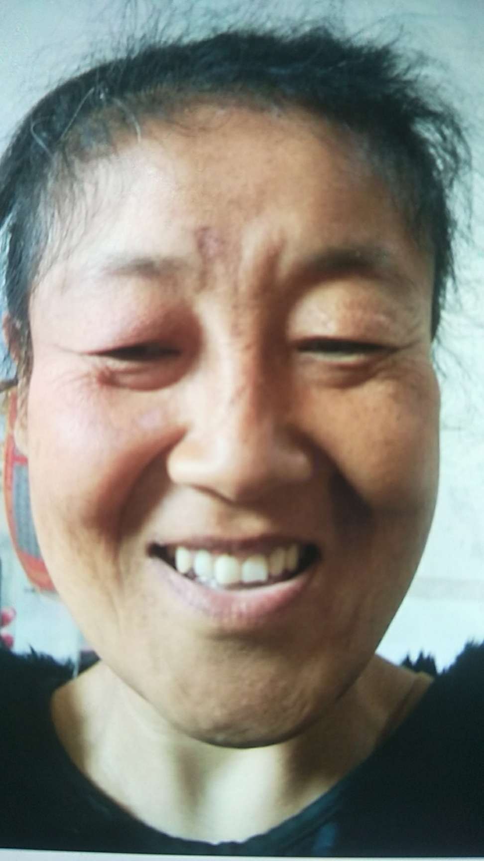 走失者照片 大家好麻烦大家帮忙转发爱心找人正能...