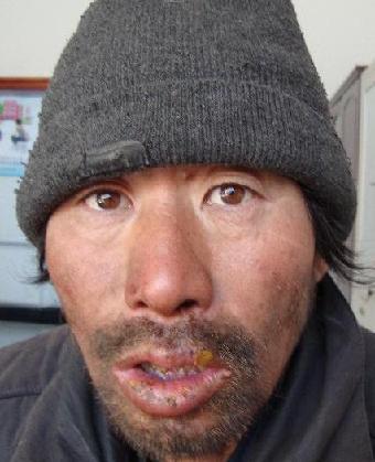 走失者照片 全国救助站