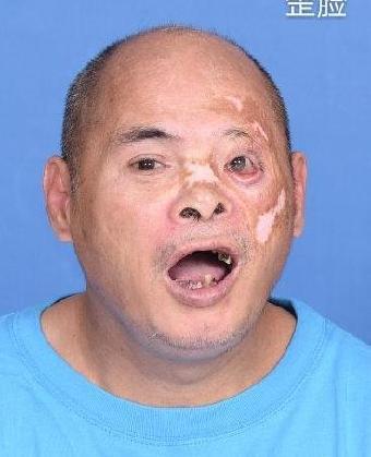 走失者照片 全国救助站
