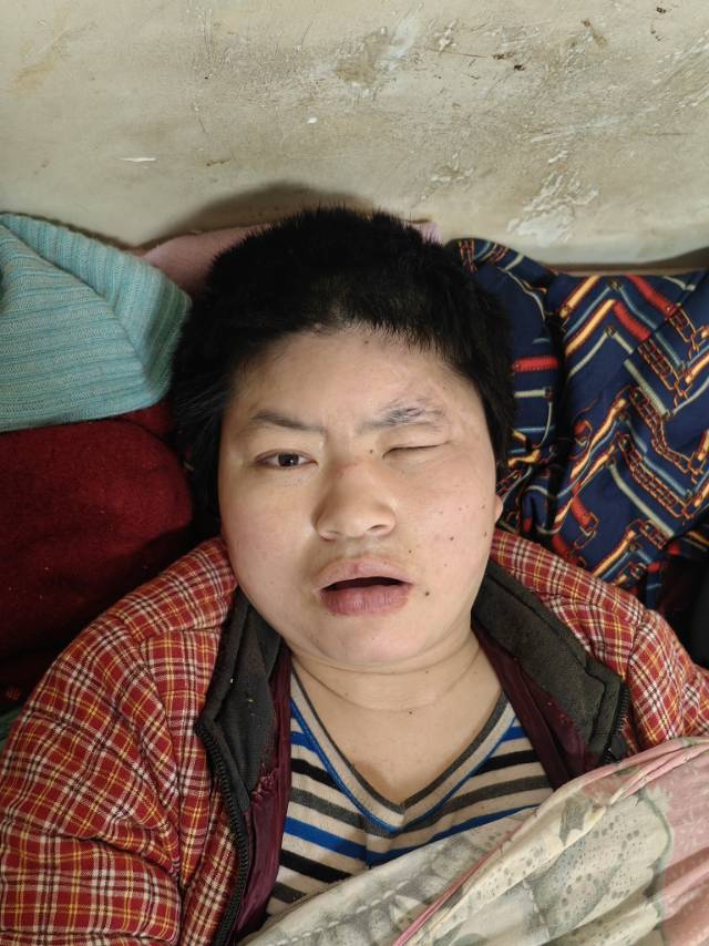 走失者照片 1994年4月被遗弃在小街二道中沟...