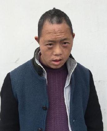 走失者照片 全国救助站