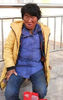 走失者照片 全国救助站