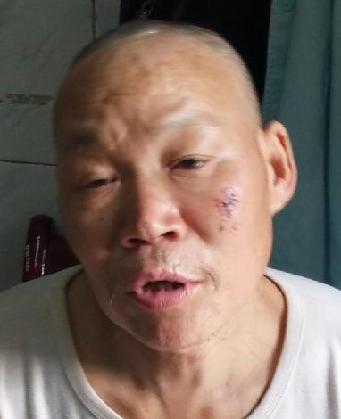 走失者照片 全国救助站