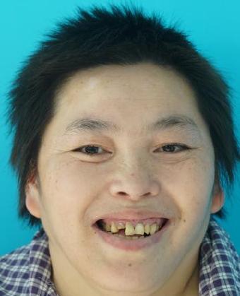 走失者照片 全国救助站