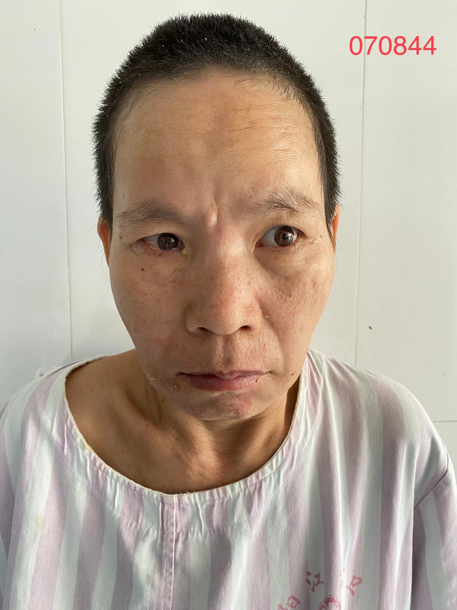 走失者照片 全国救助站