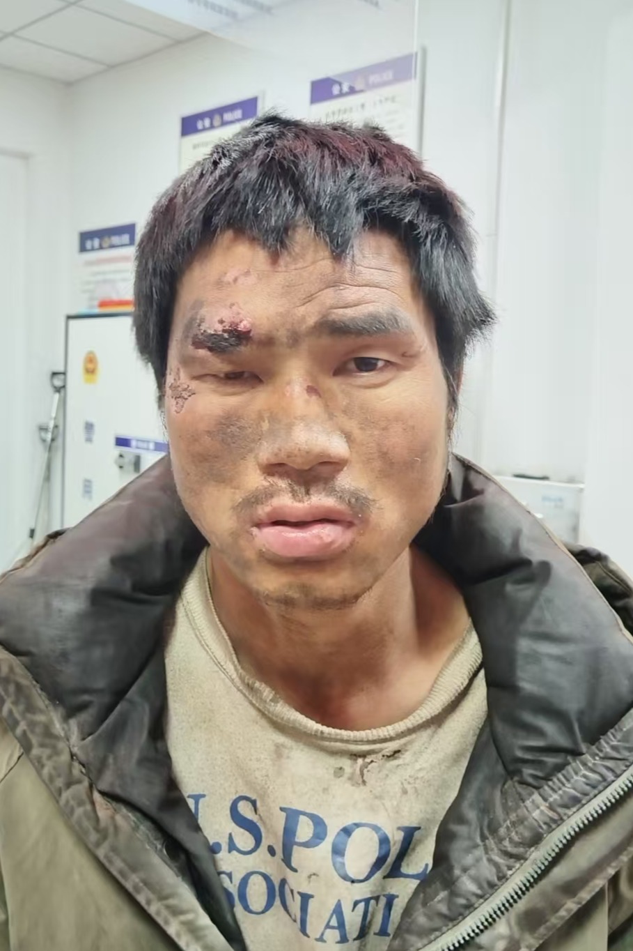 走失者照片 全国救助站