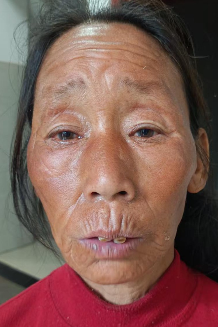 走失者照片 全国救助站