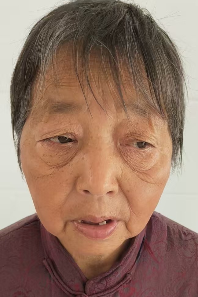 走失者照片 全国救助站