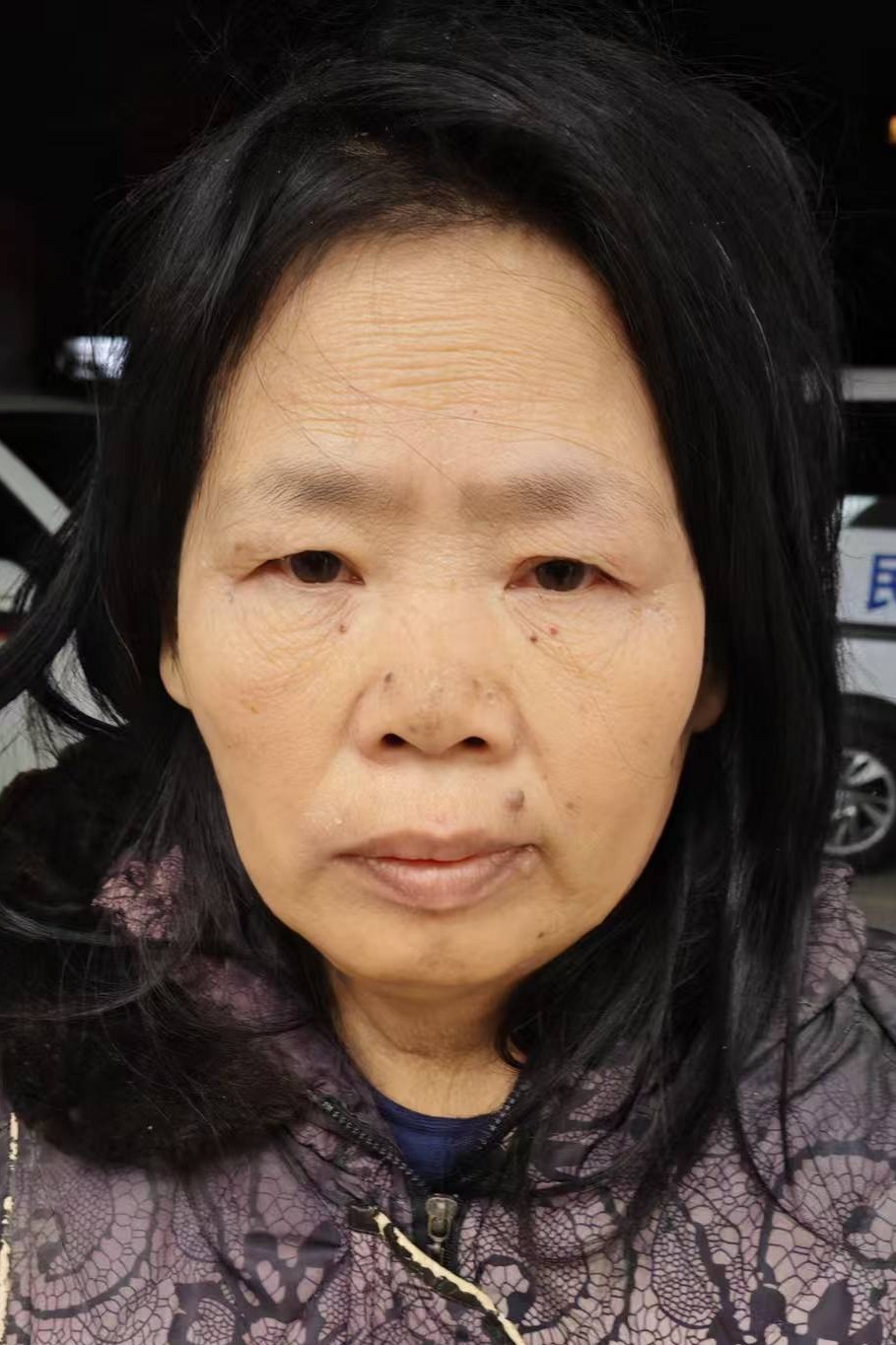走失者照片 全国救助站