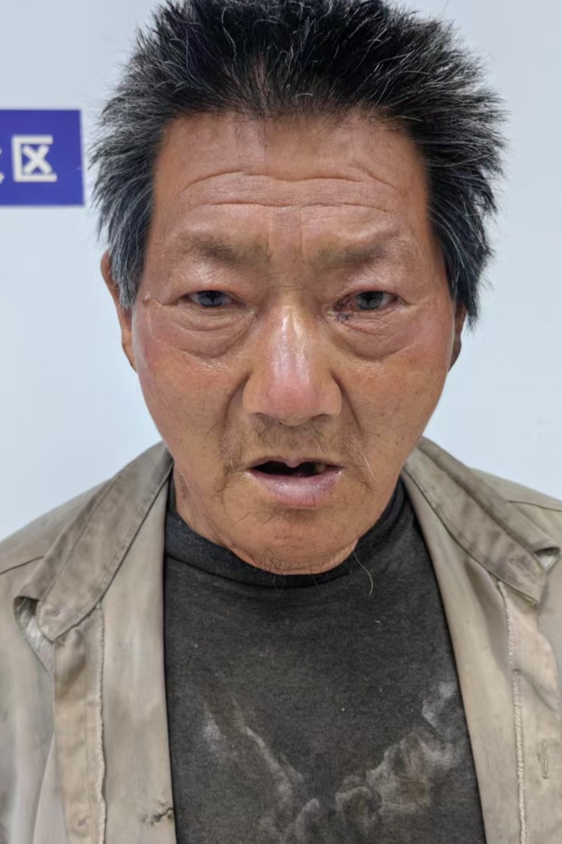 走失者照片 全国救助站