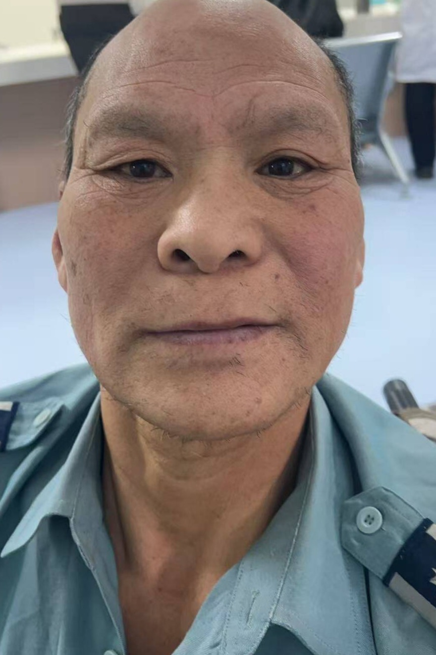 走失者照片 全国救助站