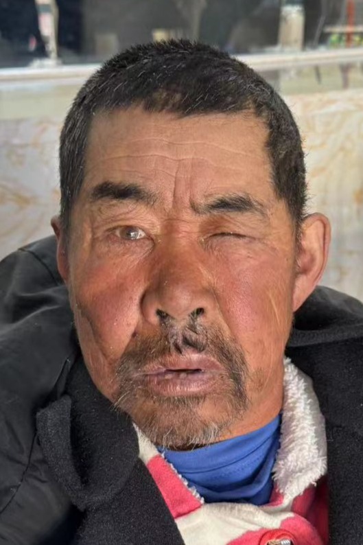 走失者照片 全国救助站