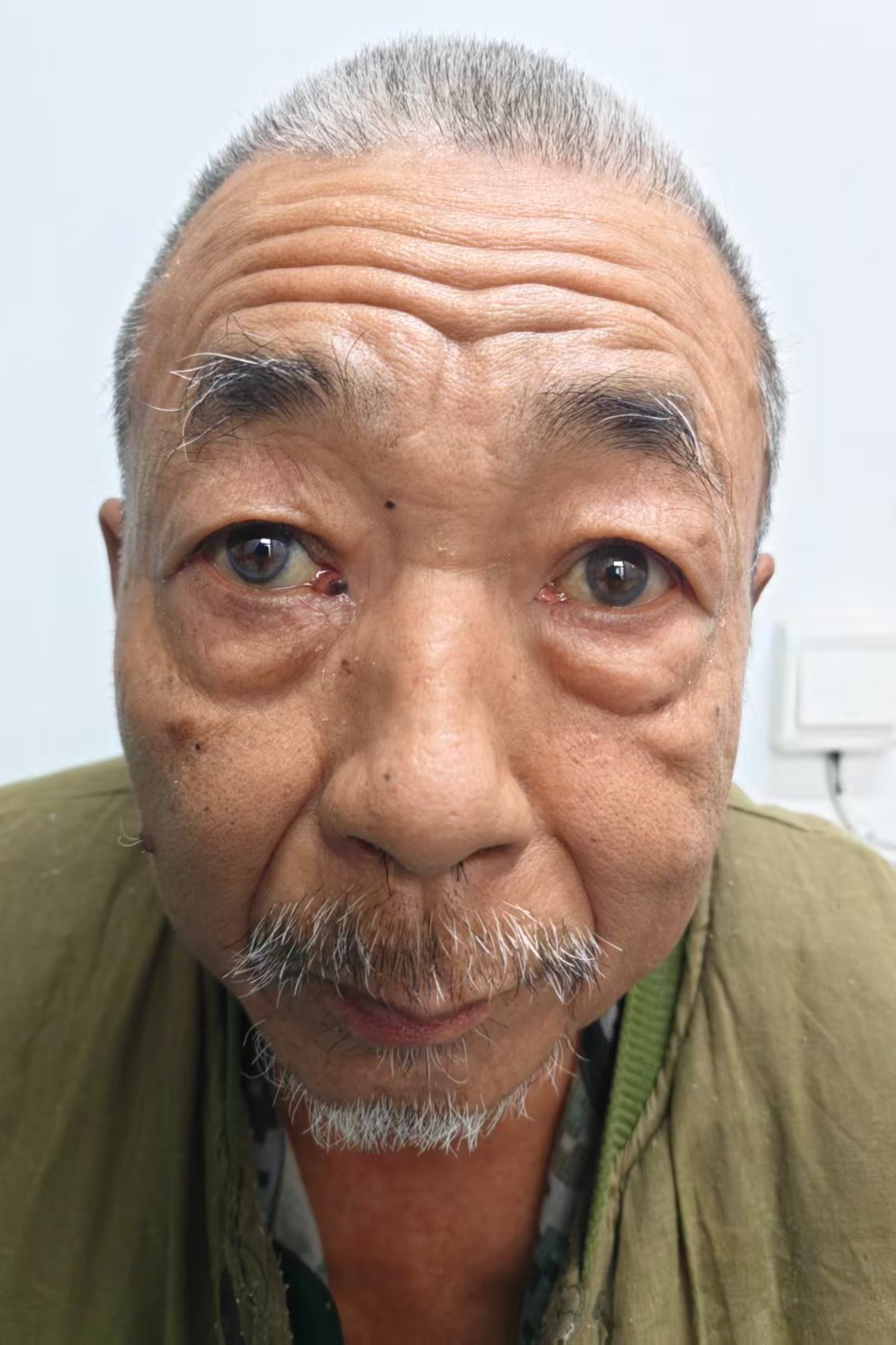 走失者照片 全国救助站