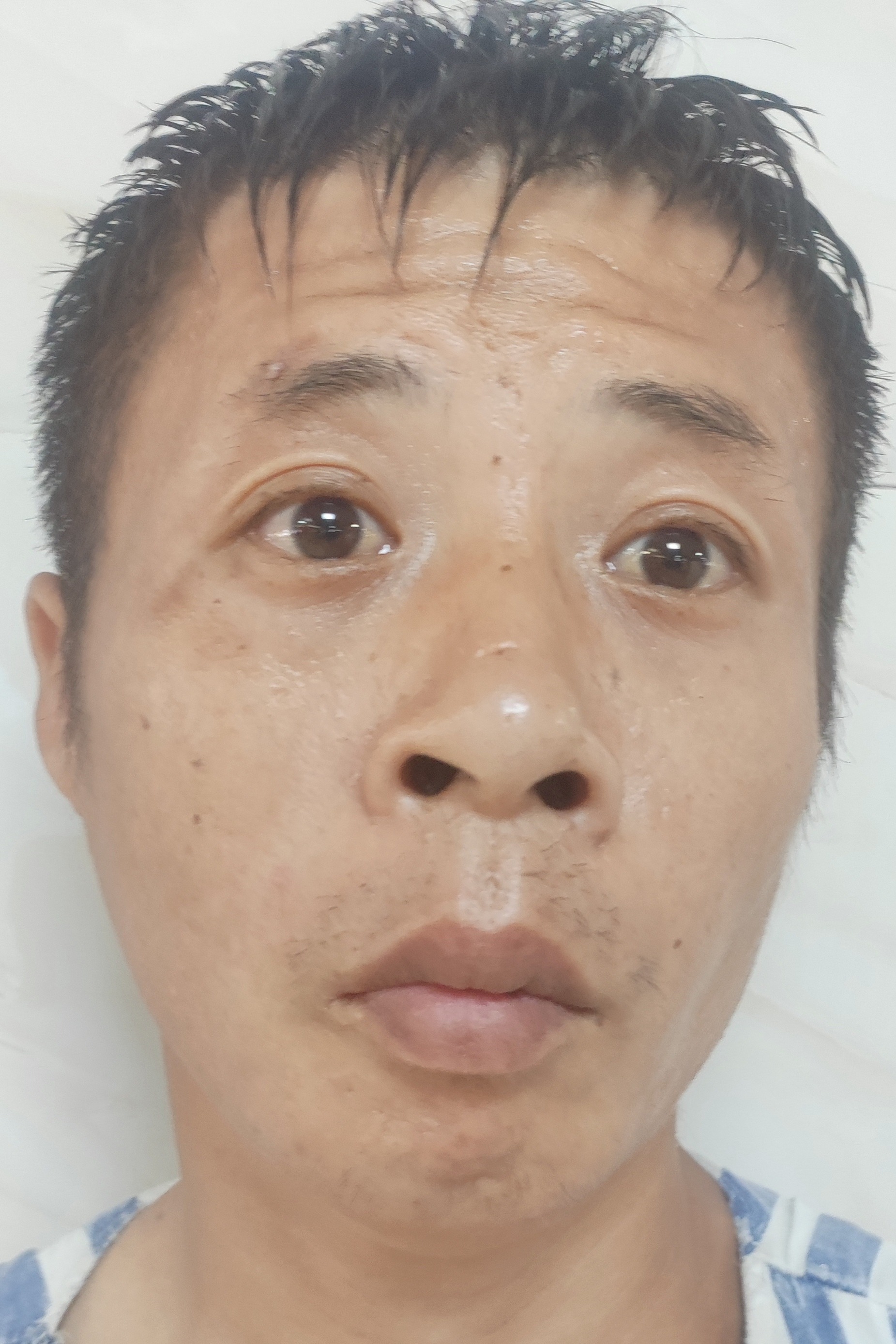 走失者照片 全国救助站