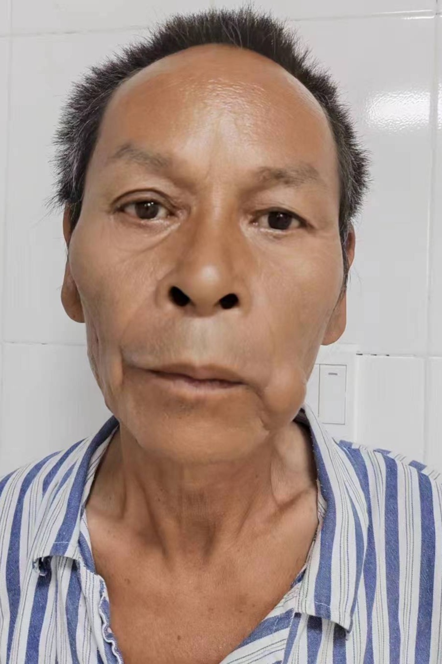 走失者照片 全国救助站
